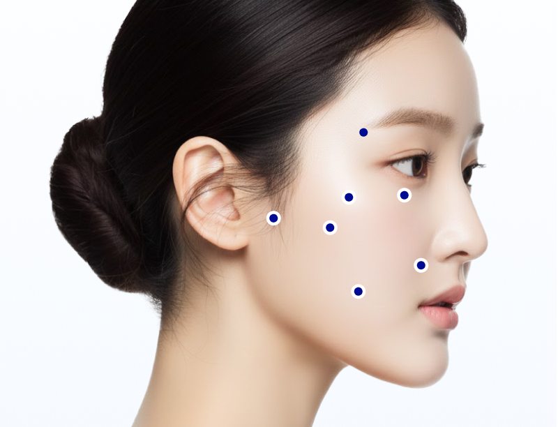 HILO WAVE 시술 부위